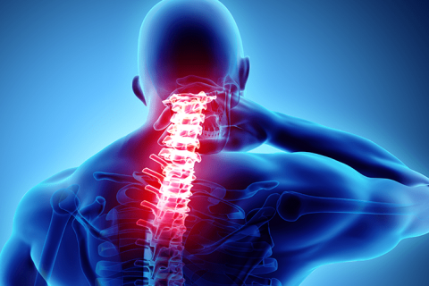 CERVICAL SPONDYLOSIS