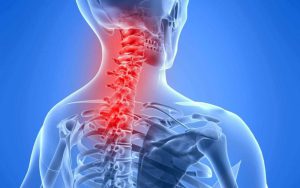 Read more about the article Cervical or Neck Pain