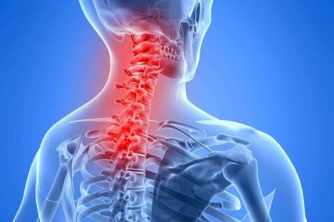 Cervical or Neck Pain