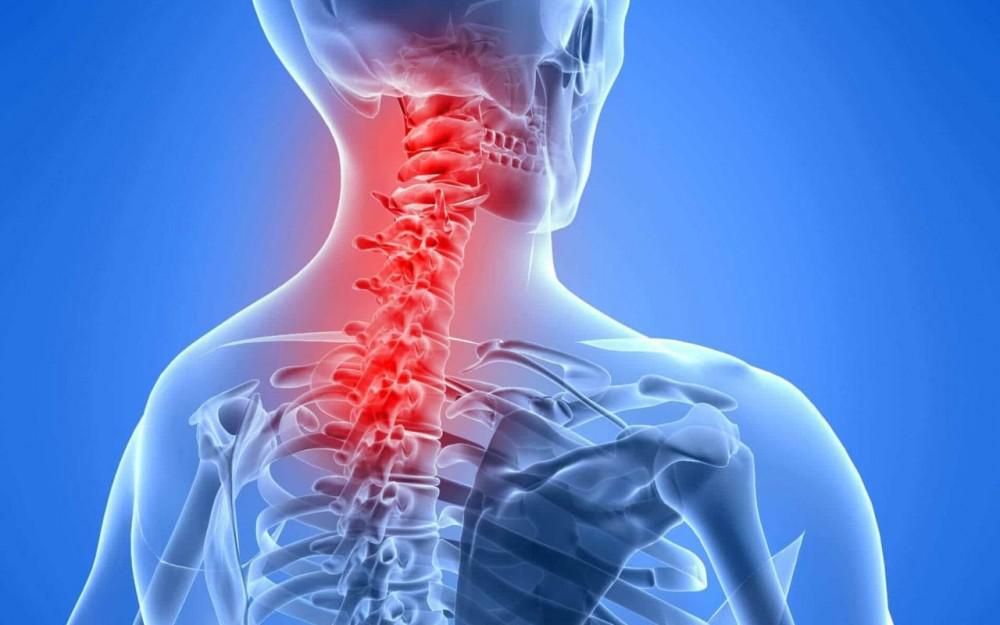 You are currently viewing Cervical or Neck Pain