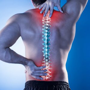 Read more about the article SPINAL ARTHRITIS