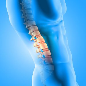 Read more about the article DEGENRATIVE DISC